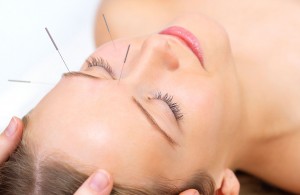 Akupunktur i pande