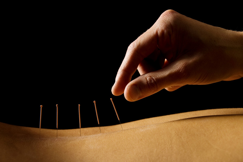 Effektiv akupunktur