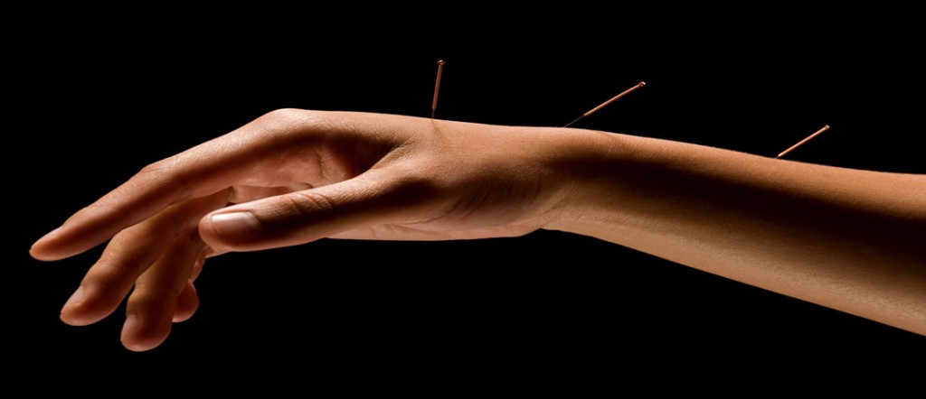 Nåle i hånden master akupunktur