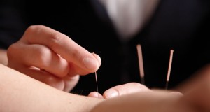 akupunktur lungecancer